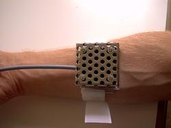 Urtikaria Temptest Prototyp
